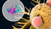 New Drug Combination More Effective Against Melanoma